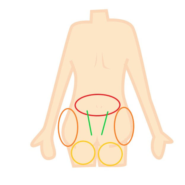 急にぎっくり腰になったとき