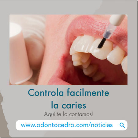 Controla facilmente la caries