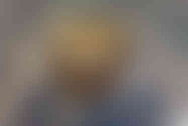 Toad head closeup, with a small biting fly between the eyes