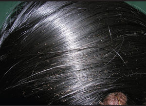 Hair Health Test 101