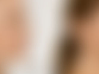 Sculptra - The Collagen Booster