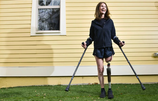 Corral walks on the artificial turf outside the house she rented for three weeks after her second surgery. It’s a good place to practice walking on uneven surfaces, she says. Photo by Cyrus McCrimmon for UCHealth.