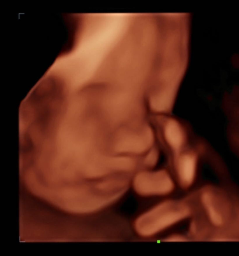 0F901804-734A-4D1A-AB8D-23B256C45773_edited