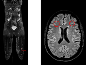 Mold Toxicity: The Great Mimicker Behind a Decade of Chronic Illness