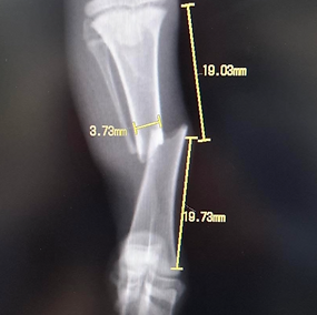 Koyomi's X ray on his leg