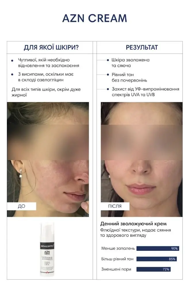Прев'ю: Braderm Azn Cream Сонцезахисний крем з протизапальним ефектом з SPF 30