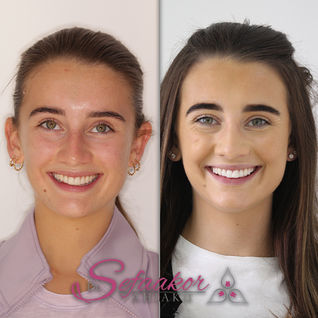 Enlighten Whitening 3.jpg