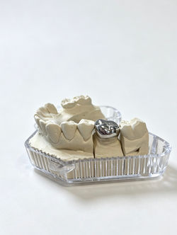Full contour metal crown