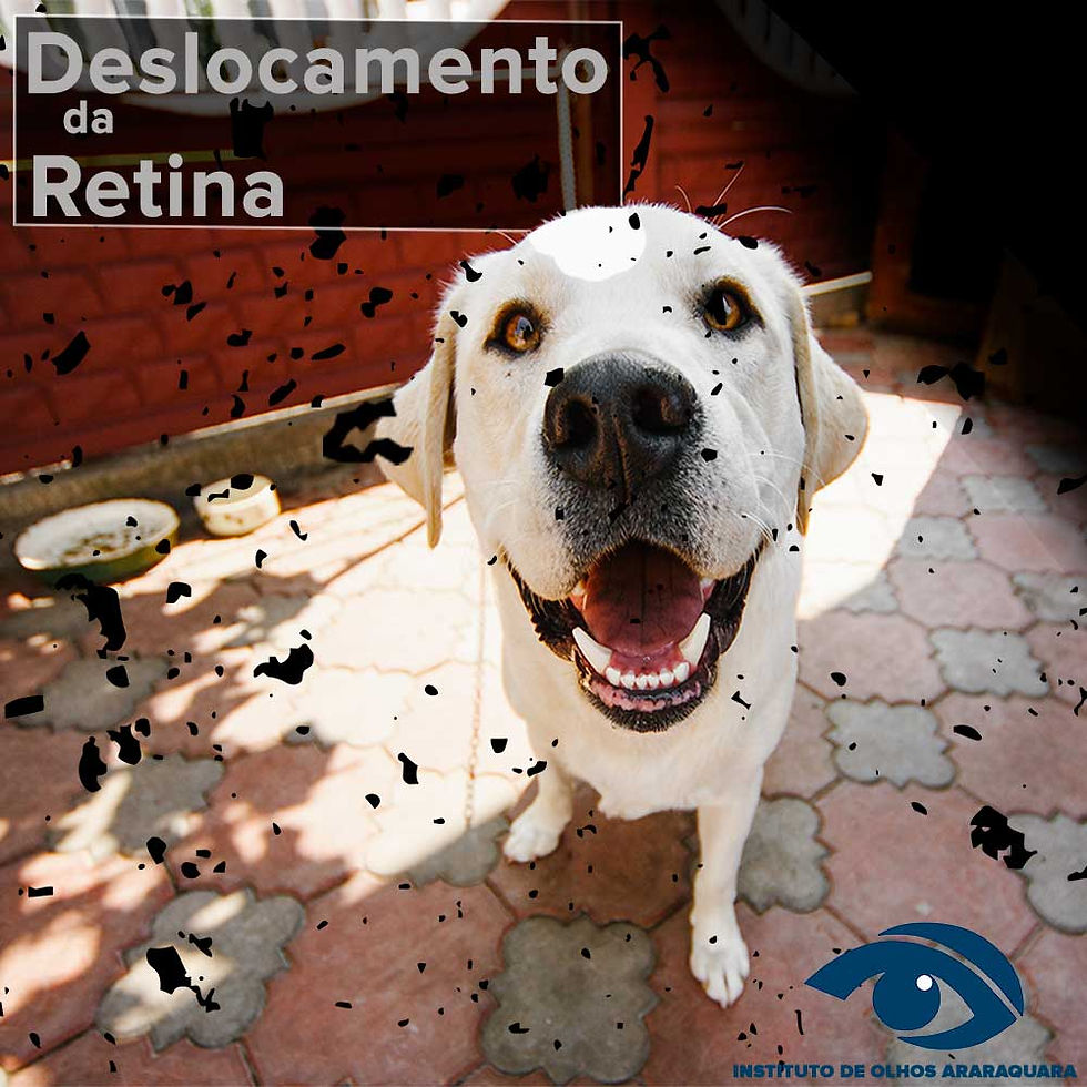 como-ocorre-o-descolamento-de-retina