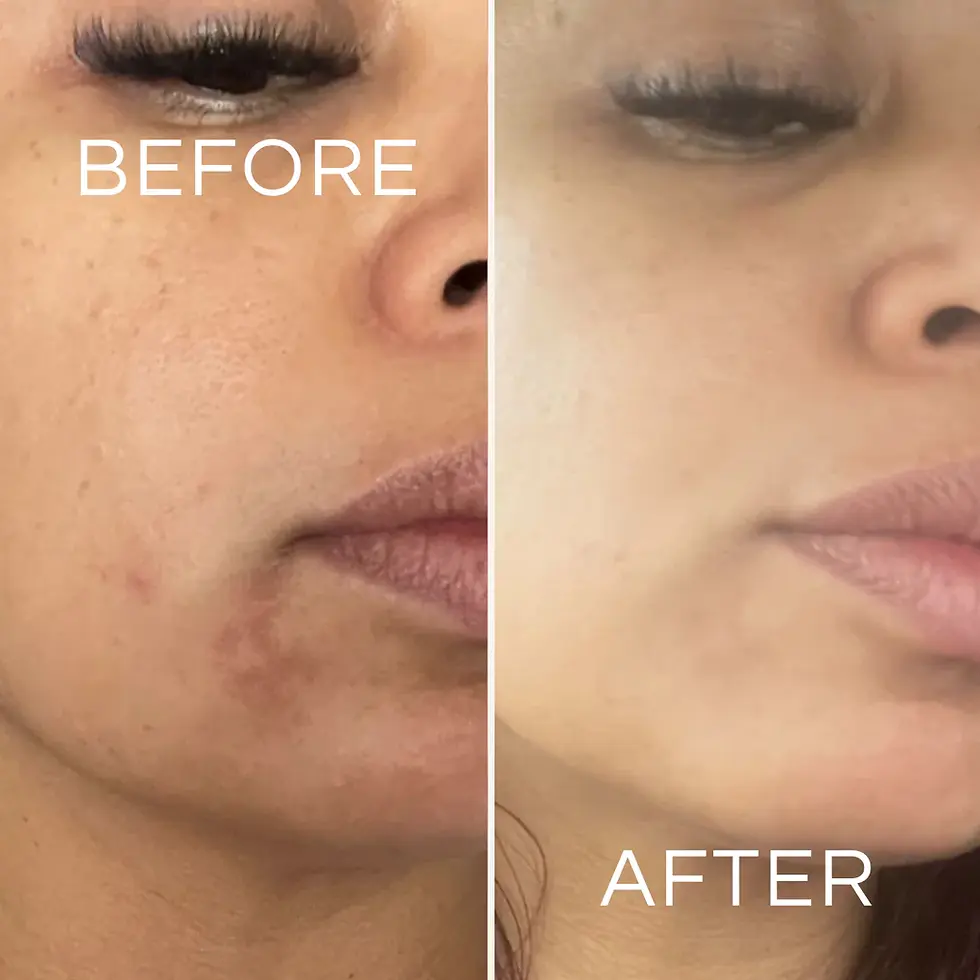 Miniatura: Koa Life Limpiador con Vitamina C