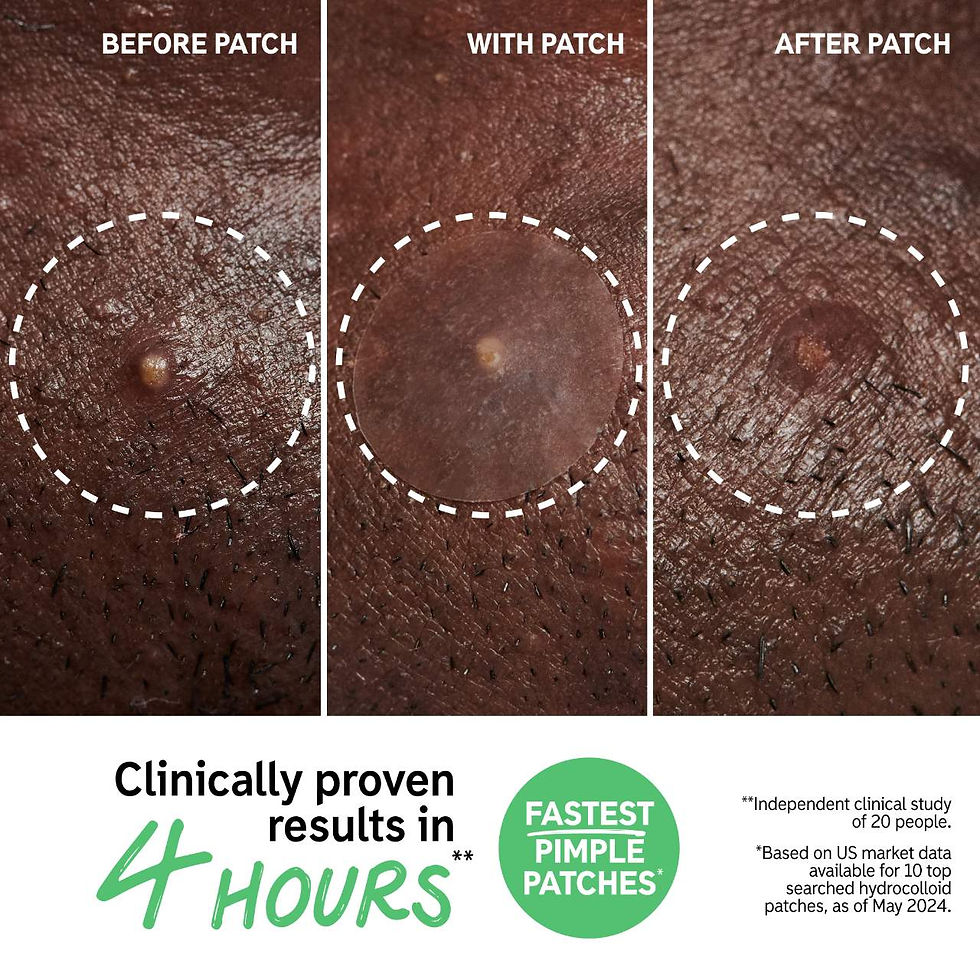 Miniatura: The Inkey List Parches para acne