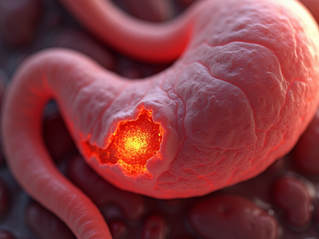 Understanding Pancreatitis: Symptoms, Causes, and Treatment Options