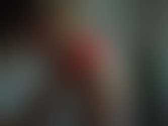 Understanding Fibromyalgia: Symptoms, Causes, and Effective Treatments