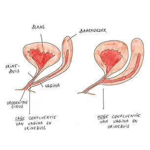 Urogenitale_Sinus.jpg