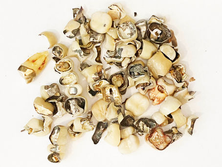 Can I sell my dental scrap?