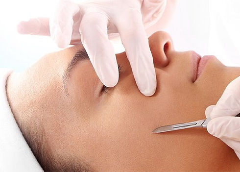 Dermaplaning-how-does-it-work.jpg