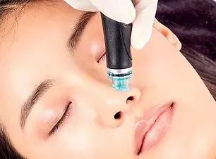 HydraFacial_Serin_TealTip_Treatment_0747.webp