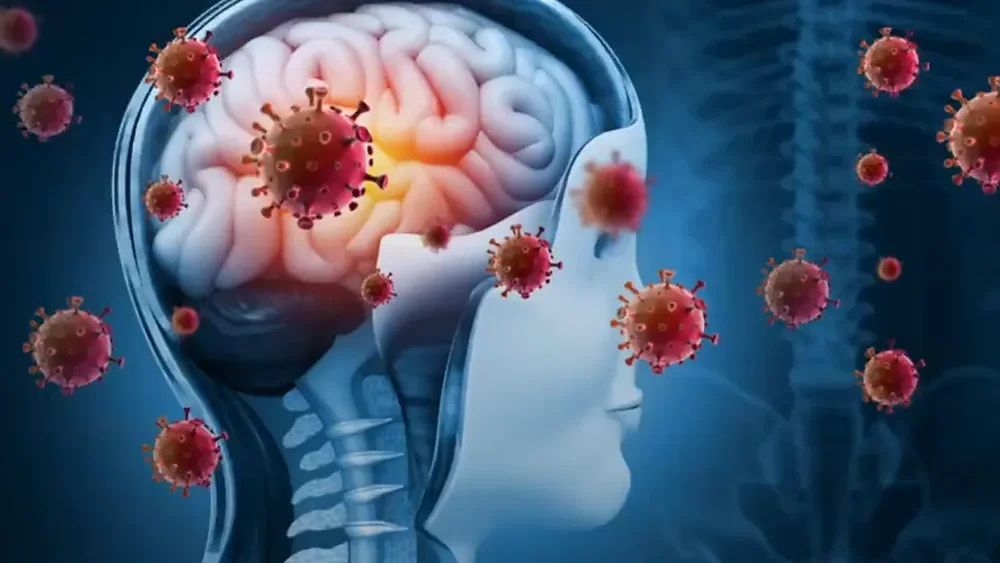 Panel De Encefalitis Meningitis FilmArray PCR LCR panel-de-encefalitis-meningitis-filmarray-pcr-lcr