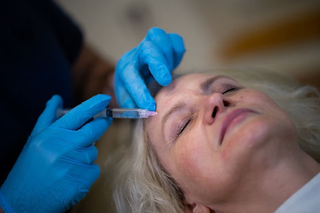  Mestherapie/Vampirlfiting  antiaging , pigmentflecken Faltenreduktion Hautverjüngng  faltenfrei 