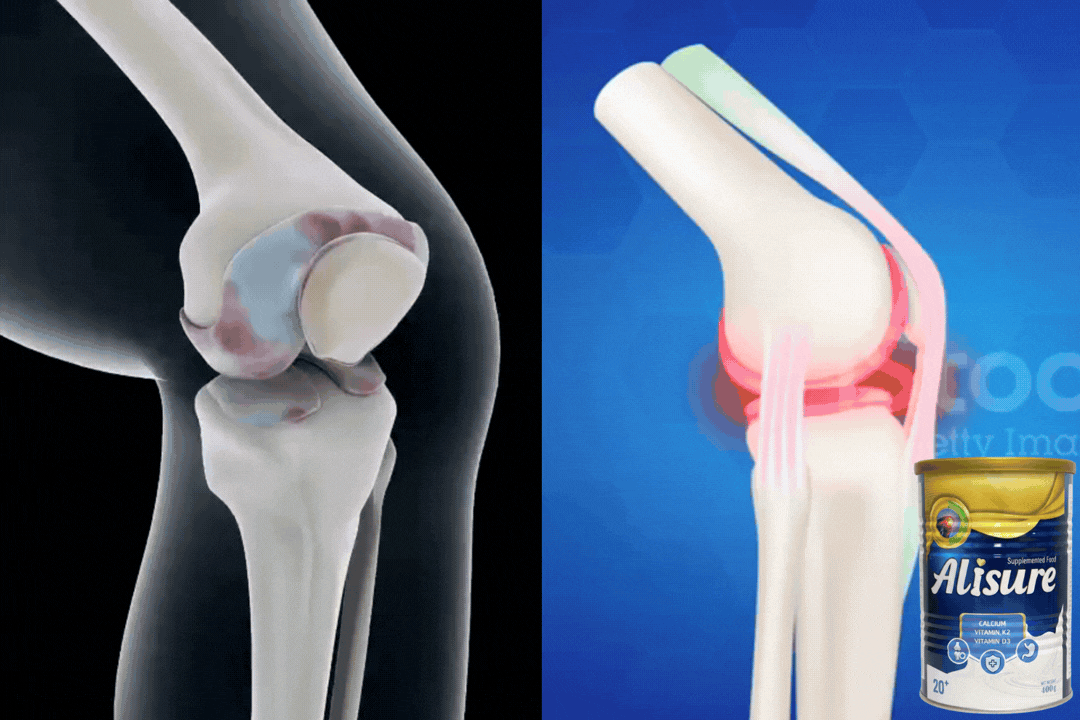 Strong Bones (900 x 1600 px).gif