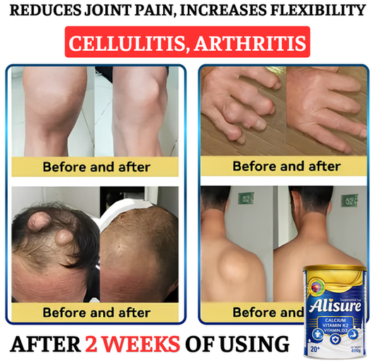 AliSure supporting arthritis joint stiffness relief
