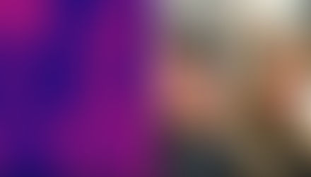 PRP capelli: guida completa (tempi, protocollo, risultati realistici)