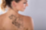 DermaPro Med Spa,kingsport tn,medicated lip balms,mud masks,botox injections,laser tattoo removal,leg hair removal,arm hair removal,back and chest hair removal,face and neck hair removal,microdermabrasion,cool sculpting,cool sculpting,skin tightening,cryolipolysis