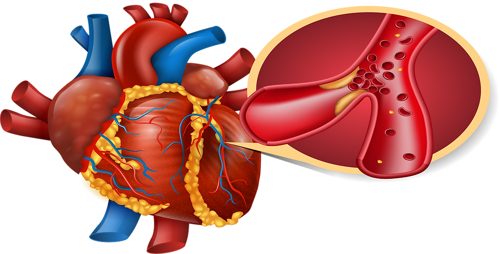 Coronary Artery Bypass Grafting cardiovascular coding