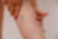 leg veins