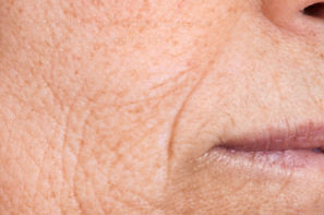 wrinkles_edited_edited.jpg