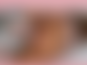 Glow Beyond the Surface: The Real Power of Microdermabrasion for Radiant Skin