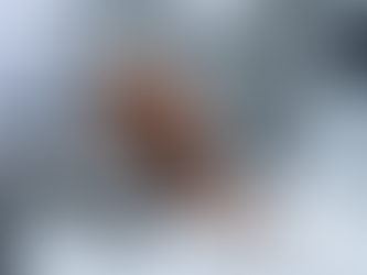 Beyond the Razor: Understanding Advanced Laser Hair Removal