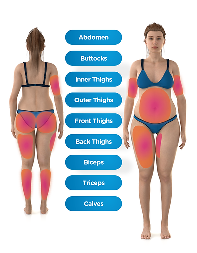 Emsculpt_Neo_PIC_Body-Parts-female_ENUS100.png