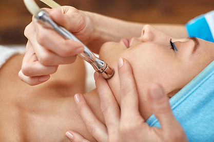 microdermabrasion.jpeg