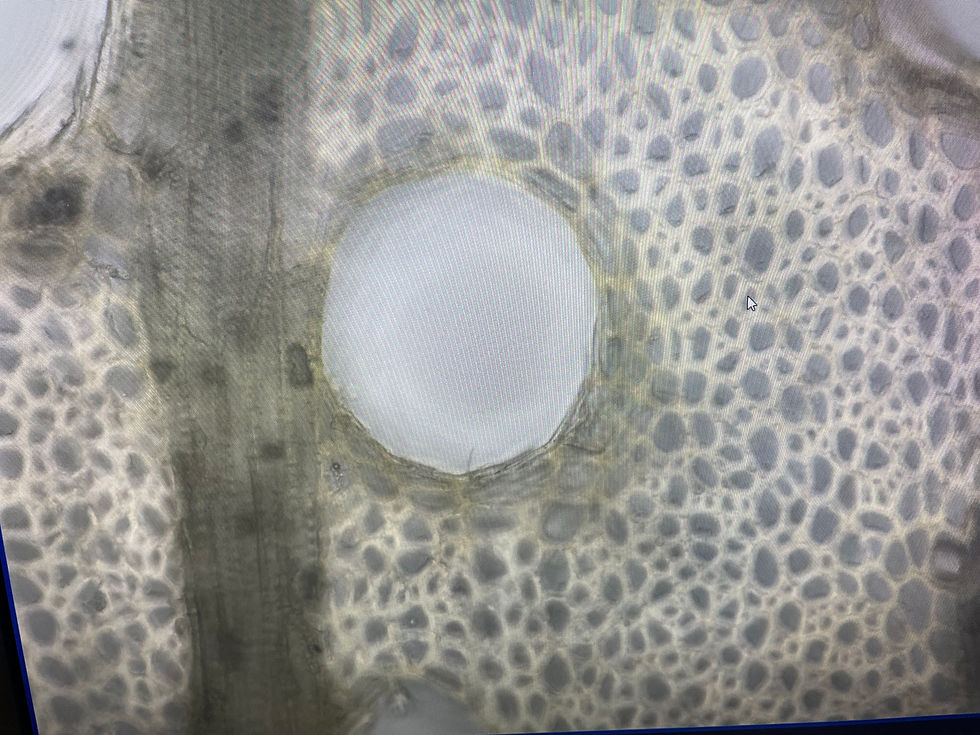 導管の様子や細胞壁がはっきり確認できる