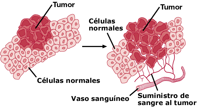 anemia_cancer_que_es01.gif