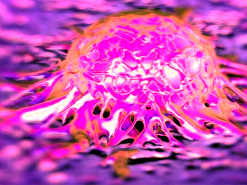 Cancer's "Kill Code"