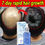 Thumbnail: Major Hair Growth Essence Tough Care Hair Improve Dry Scalp Wash Free Hair Care 