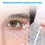 Thumbnail: 2-20Pcs Hydrogel Eye Mask Remove Dark Circles Eyes Bag Anti Wrinkles Lifting Fir