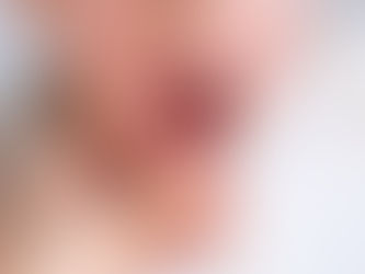 What You Need to Know About Tongue Ties: A Comprehensive Guide for Parents