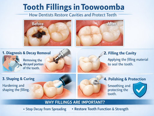 tooth fillings Toowoomba