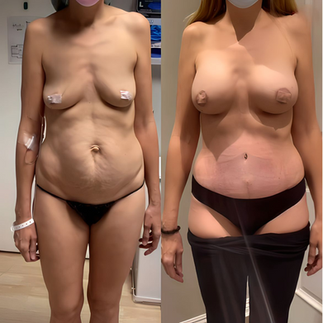 Example of surgical Before & After