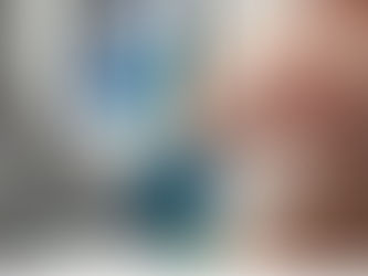 T-Junction Breakdown: the Most Common Breast Lift Complication