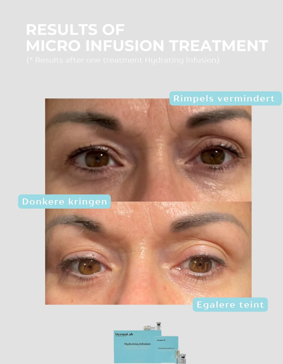 Thumbnail: Hydrating infusion systeem 3-maanden traject