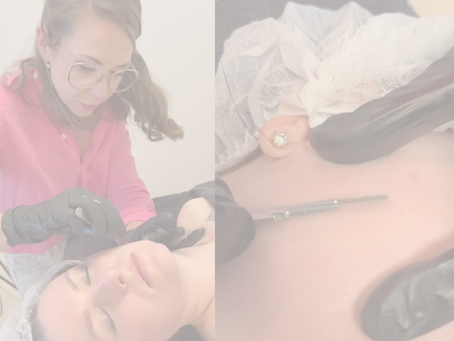Wat is dermaplaning?