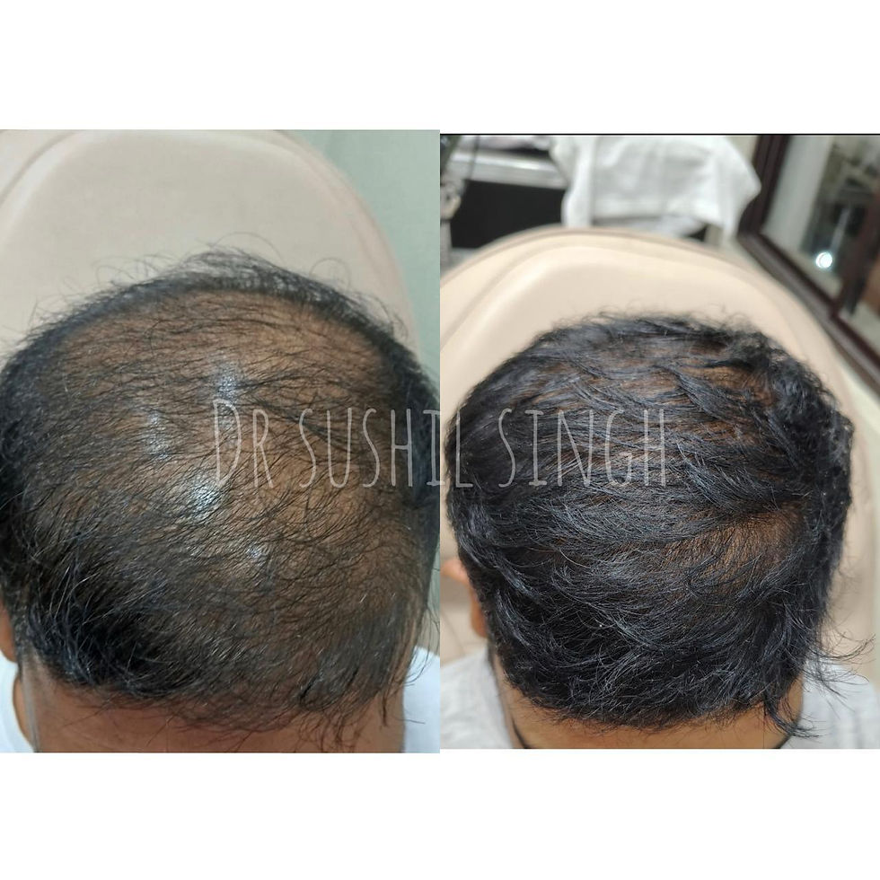 Before & After