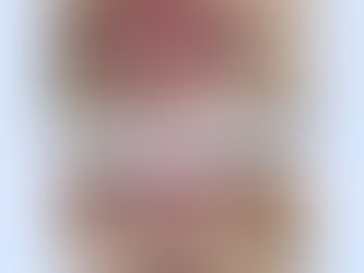驚くべき最新脱毛マシンの効果と威力!!✨〜神戸三宮メンズ脱毛サロン F roomの脱毛マシン〜