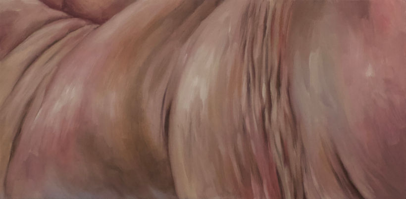 Embodiment