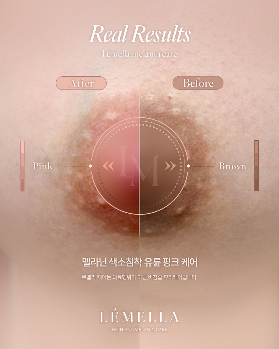 LINE_ALBUM_Lemella 照片_250608_1.jpg