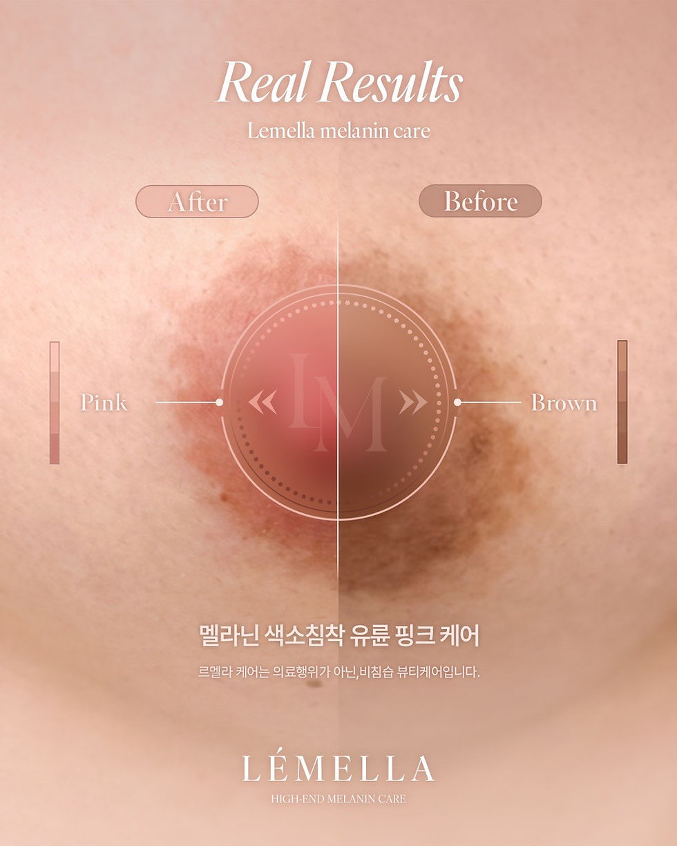 LINE_ALBUM_Lemella 照片_250608_3.jpg